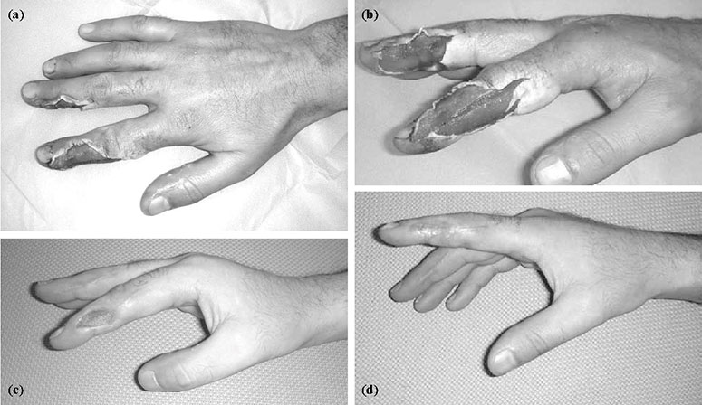 خطر مبردها برای سلامتی